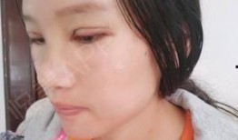 小丽爆料医美视频,医美行业背后真相，视频曝光惊人内幕