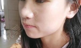 小丽爆料医美视频,医美行业背后真相，视频曝光惊人内幕